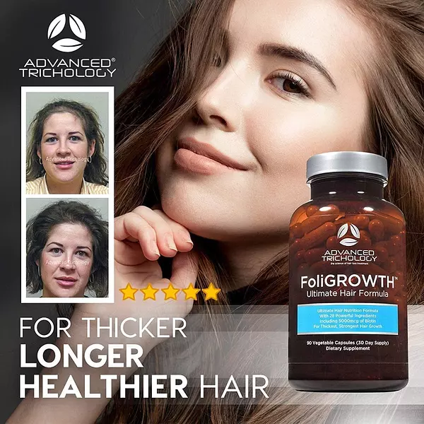 Salud y Equipamiento Médico - Vitamina Crecimiento Perdida De Cabello Foligrowth 90 Cap 4