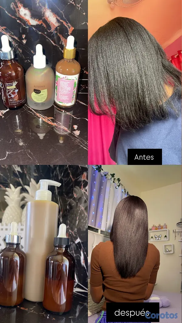 salud y belleza - gotero bomba para crecimiento y anti caída  2