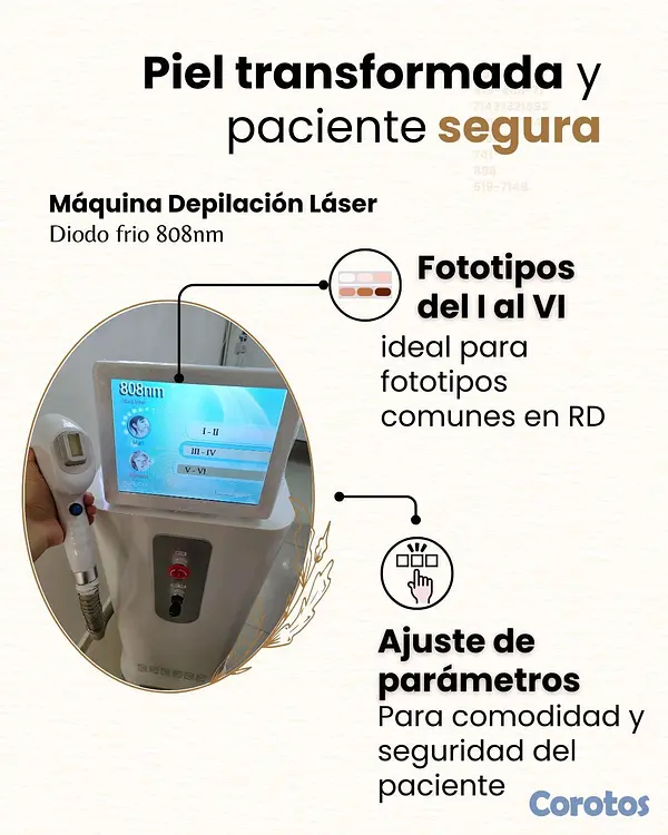 servicios profesionales - Maquina depilacion laser diodo frío 810nm 3